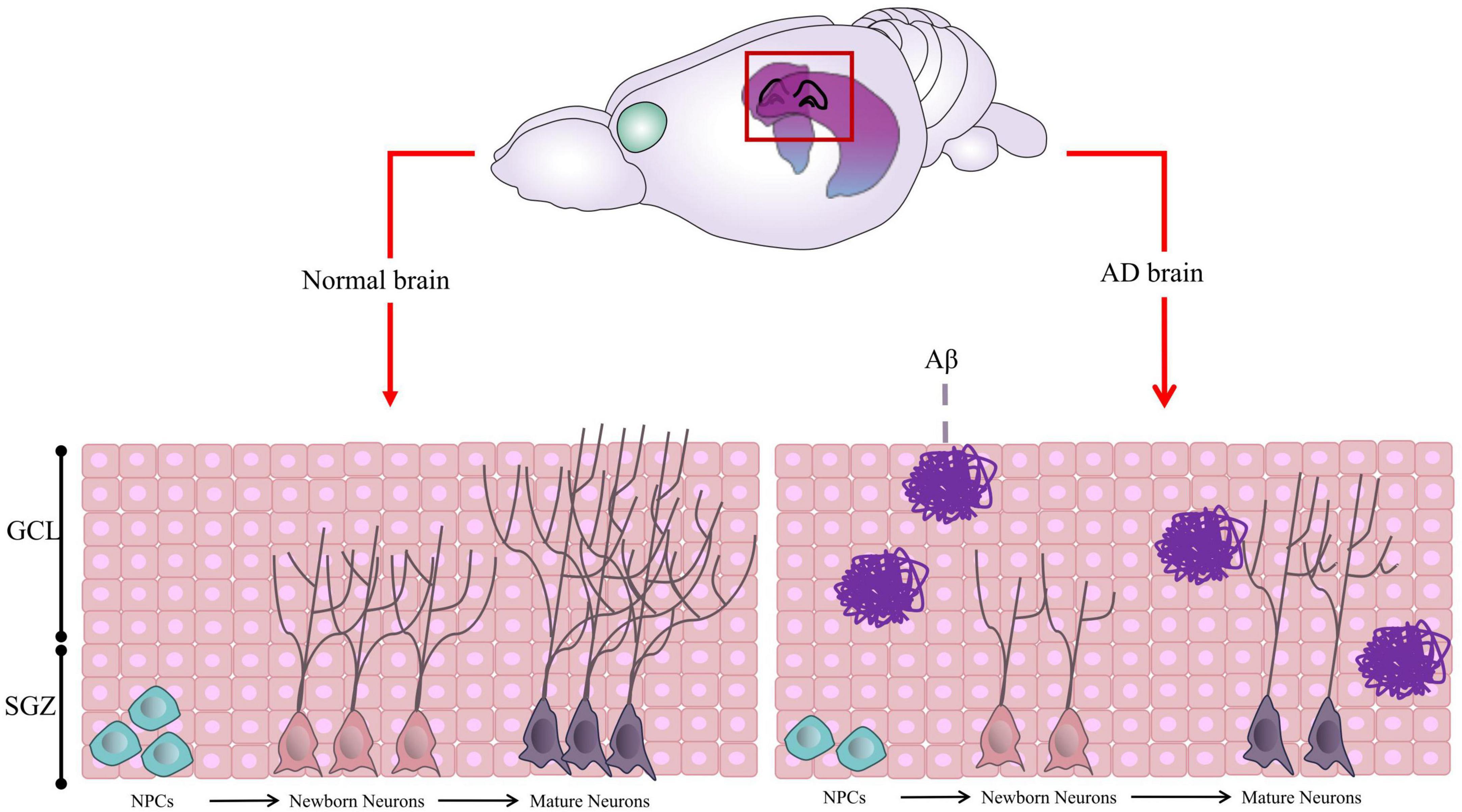 Mechanisms of abnormal adult hippocampal neurogenesis in Alzheimer’s disease